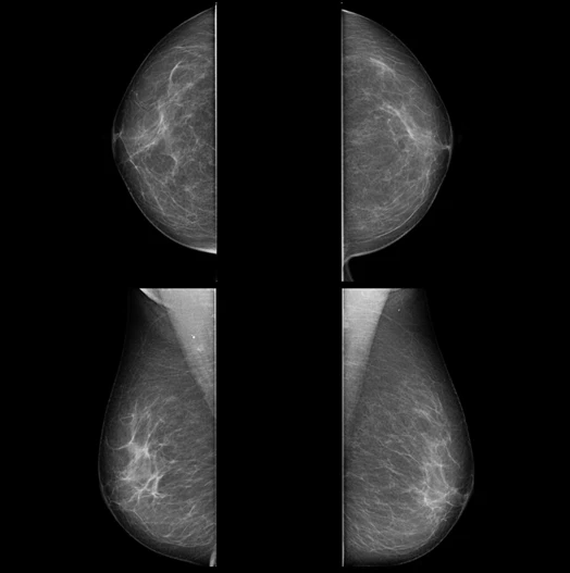 MX-600 · Clinical images 5